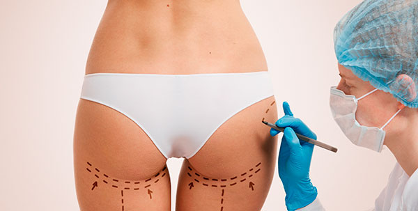 lipokontur tratamientos post quirurgicos liposuccion